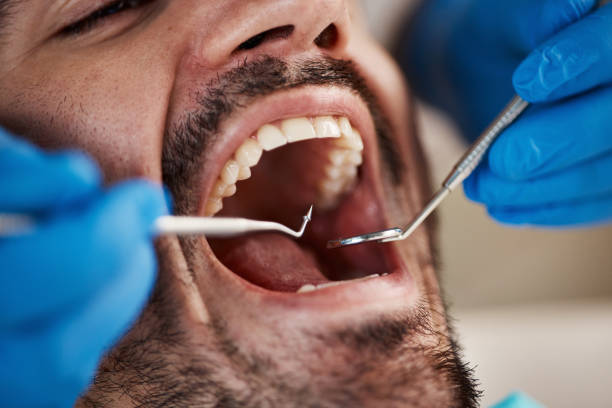 Best Emergency Dental Services for Seniors in Stallings, NC