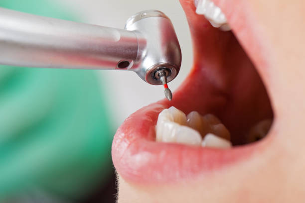 Best Emergency Cosmetic Dentistry in Stallings, NC